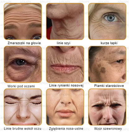 ΑPΚΑPK™ Jad Pszczoły Kompleksowy Krem🥇🥇pomaga w leczeniu problemów skórnych, takich jak: zmarszczki, blizny, plamy pigmentacyjne, rozstępy, trądzik, łuszczyca, egzema, zmiany skórne, podrażnienia, stany zapalne i inne problemy skórne🔥🔥🔥